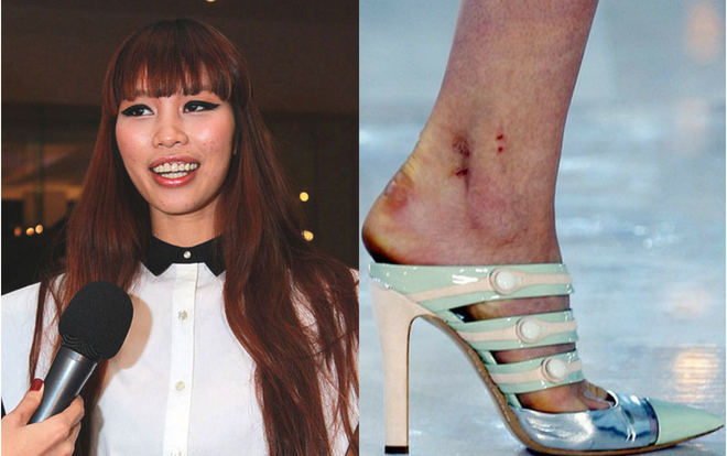 Muốn thành công, người mẫu phải đối diện những 'căn bệnh thế kỉ' chưa bao giờ trị dứt Ảnh 2