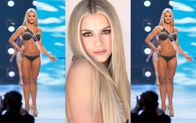 Người đẹp 'nấm lùn' sở hữu thân hình nóng bỏng đăng quang Hoa hậu Mỹ 2018 Ảnh 2