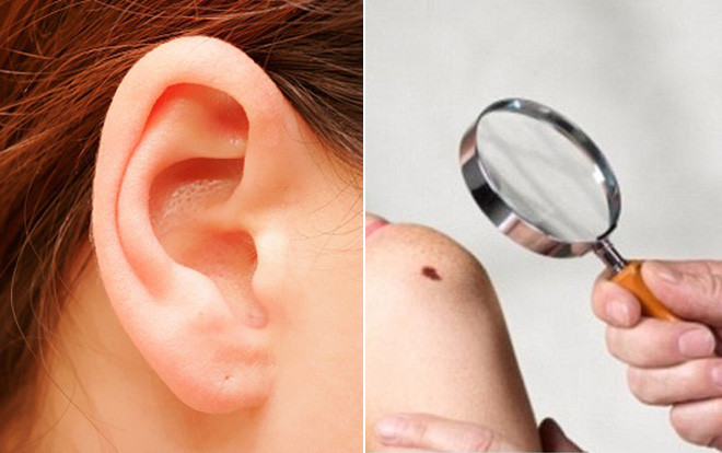 Lông mọc nhiều ở 4 vị trí này, tài lộc đến không cản được Ảnh 2