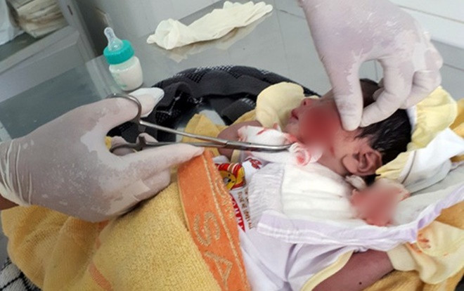 Cứu kịp thời bé sơ sinh bị chôn sống Ảnh 2