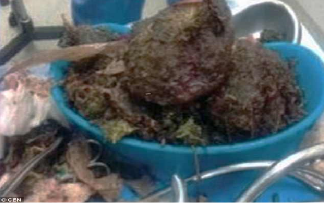 'Thai phụ' than phiền không thấy em bé cử động và sự thật gây sốc Ảnh 2