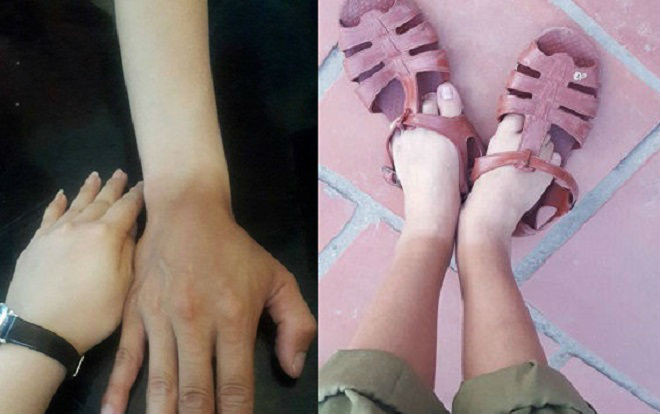 Cư dân mạng bật cười với hình ảnh 'đặc sản' sau mùa quân sự của sinh viên: Da dẻ loang lổ 2 màu vì nắng nóng Ảnh 2