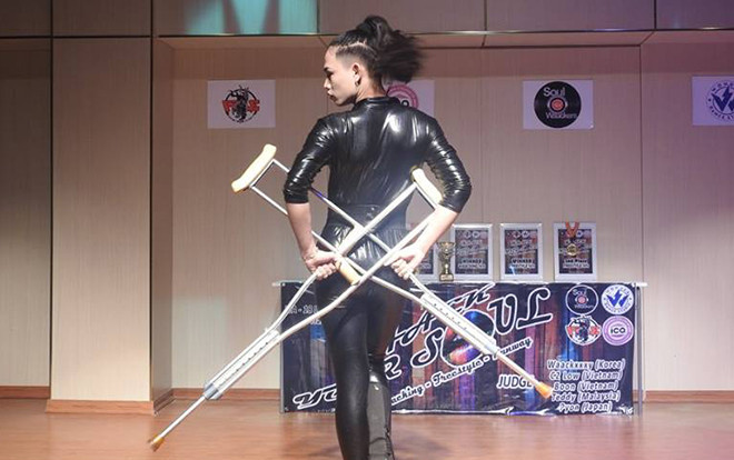 Trầm trồ xem màn trình diễn bốc lửa của nam vũ công trẻ với một bên chân bó bột Ảnh 2