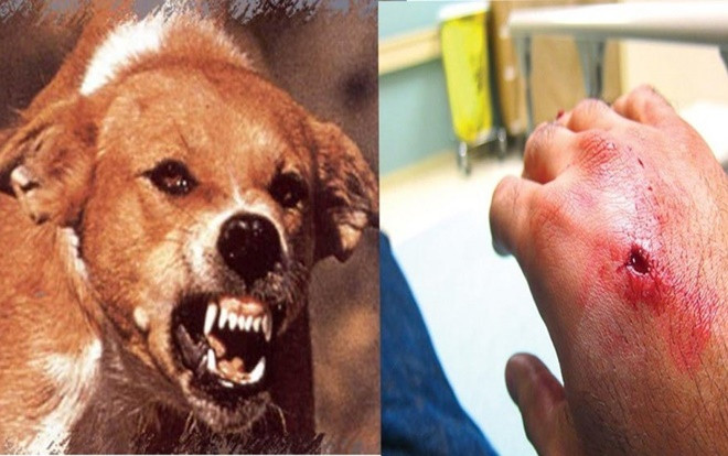 Quá chủ quan, bác sĩ thú y tử vong vì chó cắn chỉ sau 1 ngày phát bệnh Ảnh 2