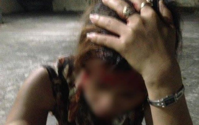 Vụ bồ nhí đánh ghen ngược với vợ của nhân tình: Chuyển hồ sơ lên công an huyện thụ lý Ảnh 2