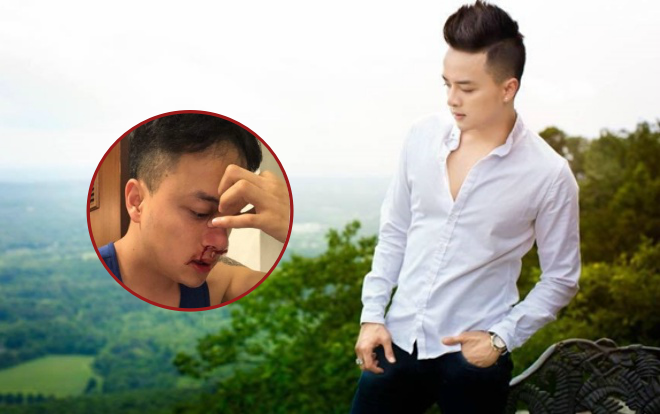 Đồng nghiệp V-biz lo lắng khi Cao Thái Sơn bị chảy máu mũi, phải nhập viện cấp cứu lúc nửa đêm Ảnh 2