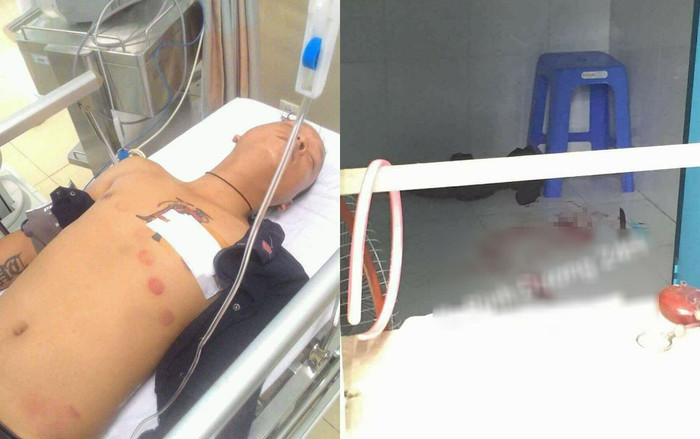 Sát hại bạn gái rồi tự tử nhưng không thành, cơ quan điều tra đợi đối tượng tỉnh lại để lấy lời khai Ảnh 2