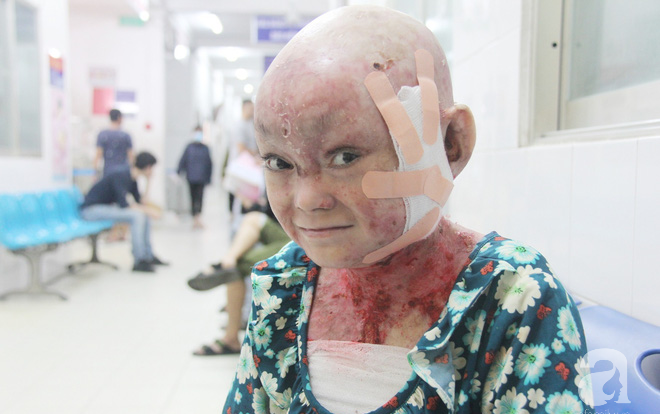 Nghĩ mình sẽ chết, cô gái trẻ bị lở loét khắp người đem tiền chữa bệnh đi xây cầu cho người nghèo, giờ phải sống lay lắt qua ngày Ảnh 2