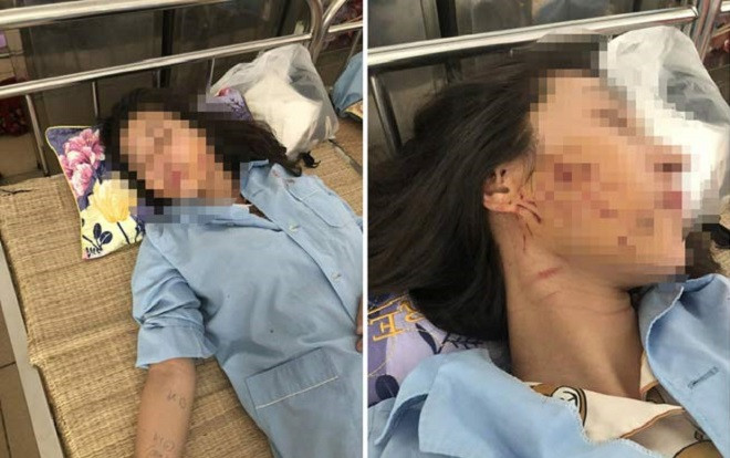 Vụ đánh ghen kinh hoàng: Cô gái bị lột đồ, đổ nước mắm và muối ớt vào người lên tiếng Ảnh 2
