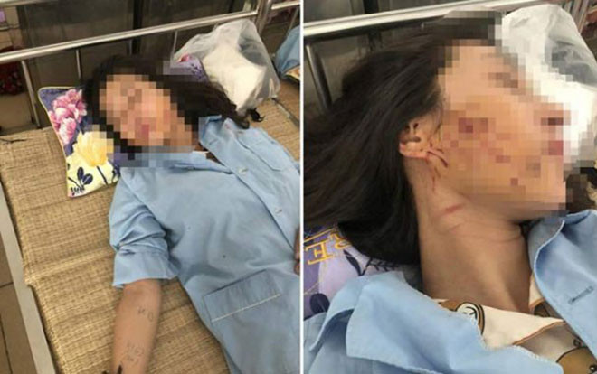 Báo cáo Bộ Công an vụ chủ tiệm spa bị lột đồ, đổ nước mắm và muối ớt nghi do đánh ghen Ảnh 2