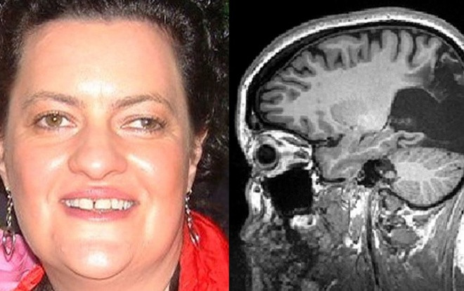 Bệnh lạ khiến người phụ nữ mù chỉ nhìn thấy những vật đang chuyển động Ảnh 2