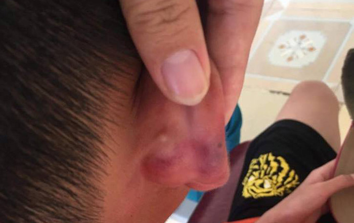 Triệu tập mẹ kế làm rõ vụ nghi bạo hành con chồng 12 tuổi nhập viện Ảnh 2