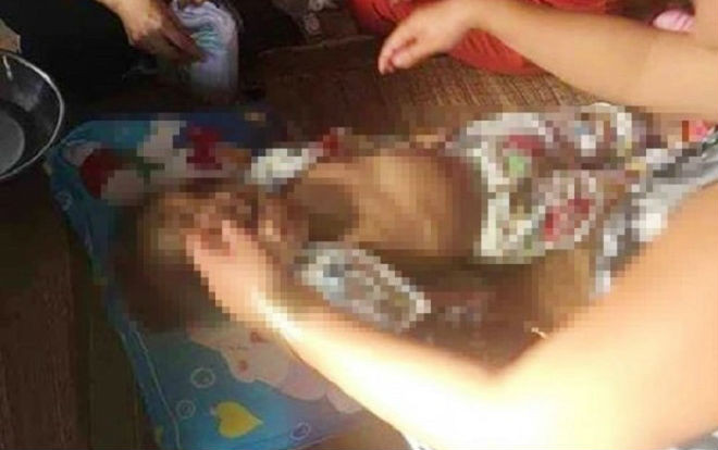 Bé gái nghi bị bạn của cha đánh tử vong: Cha mẹ ly hôn, thiếu thốn tình cảm gia đình từ bé Ảnh 2