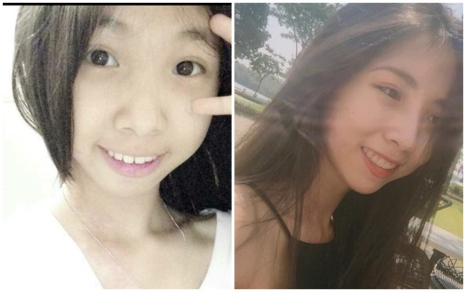 Nhờ niềng răng, cô bé lọ lem răng hô ngày nào hóa thành thiên thần 'vạn người mê' Ảnh 2