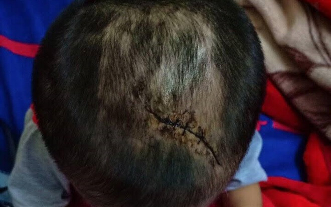 Nghi bé trai 3 tuổi bị mẹ ruột cùng cha dượng đánh đập đến thương tích Ảnh 2