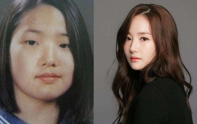 Những sao Hàn nhan sắc lên hương, cuộc đời sang trang sau phẫu thuật thẩm mỹ Ảnh 2
