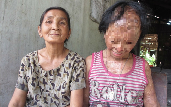 Nghẹn lòng ước mơ của bé gái bị tình địch của mẹ tạt a-xít mù hai mắt Ảnh 2