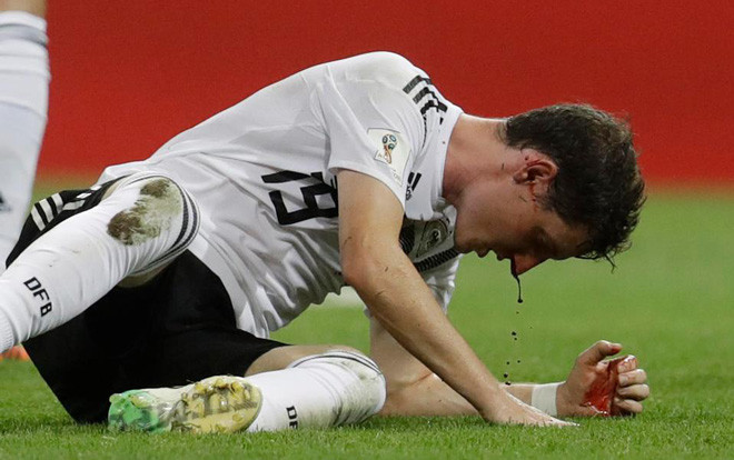Cận cảnh pha chấn thương kinh dị của tuyển thủ Đức Ảnh 2