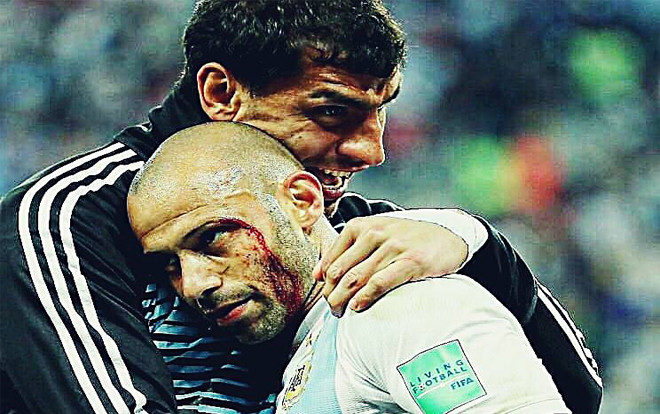 Đổ máu, ‘chiến binh’ của ĐT Argentina vẫn nỗ lực thi đấu Ảnh 2