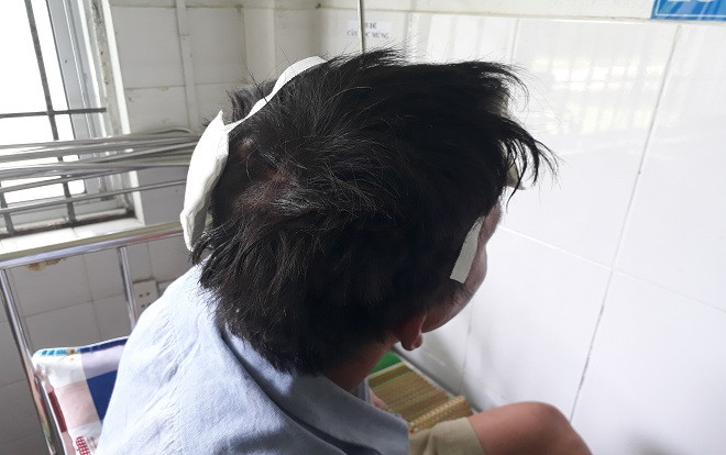 Bị hàng xóm chém tới tấp vào đầu vì thắc mắc kèo độ World Cup Ảnh 2