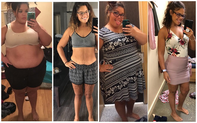 Cô gái trẻ gây shock khi tăng đến 145kg rồi giảm 80kg trong thời gian ngắn Ảnh 2