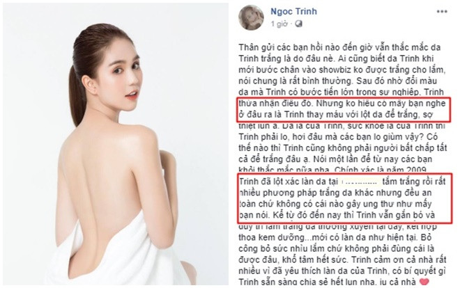 Ngọc Trinh phản bác lời đồn 'lột da, thay máu', cô khẳng định đã tắm trắng nhưng an toàn Ảnh 2