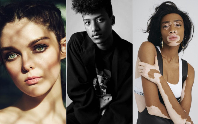 Những người mẫu bị kỳ thị lội ngược dòng trở thành viên ngọc đắt show trong làng mốt Ảnh 2