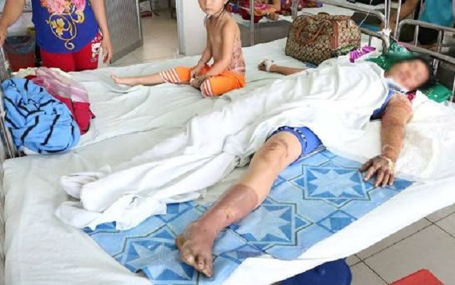 Người đàn ông tạt xăng đốt người tình vì đòi chia tay rồi tự thiêu Ảnh 2