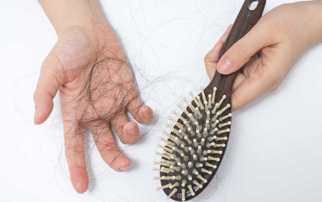 Nếu không tuổi 17 mà tóc như 71, hãy tránh xa 5 lỗi gây rụng tóc hói đầu dưới đây! Ảnh 2