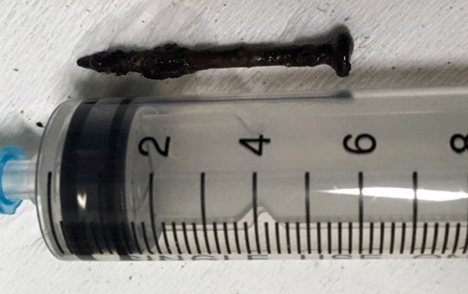 Tai nạn hy hữu: Vô tình há miệng trong lúc đóng tàu, người đàn ông bị đinh rơi vào phổi Ảnh 2