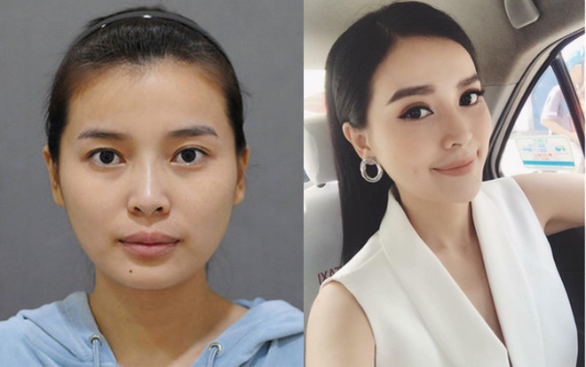 Vừa mới hot nhờ trúng vai Trung úy Minh Ngọc (Hậu duệ mặt trời Việt), Cao Thái Hà đã bị 'đào mộ' ảnh thời chưa thẩm mỹ Ảnh 2