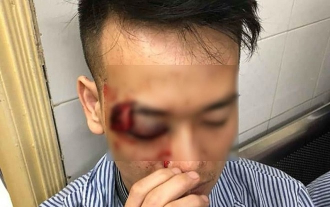 Đi ăn đêm cùng nhóm bạn, một thanh niên bị đối tượng lạ mặt đâm mù mắt Ảnh 2