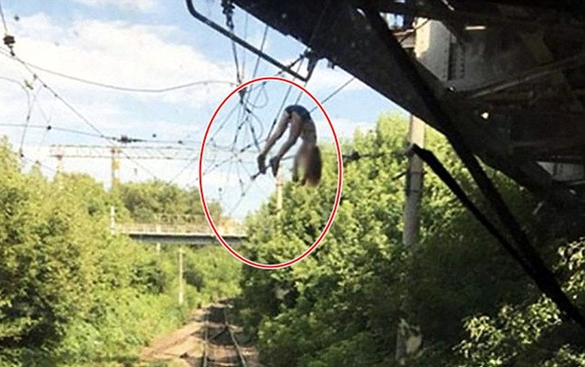 Bé gái ngã xuống đây điện cao thế 3.000 volt, vắt vẻo suốt một tiếng nhưng vẫn sống sót kỳ diệu Ảnh 2