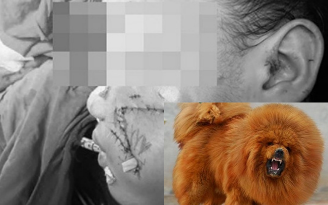 Kinh hoàng bé gái 8 tháng tuổi ở Hà Nội bị chó ngao Tây Tạng cắn tử vong Ảnh 2