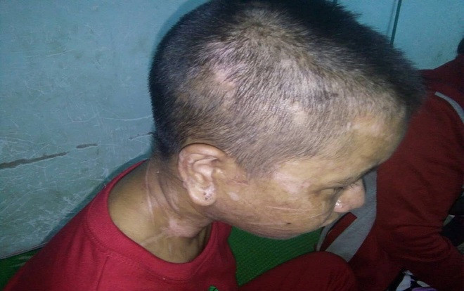 Thiếu nữ đi làm thuê nghi bị đánh đập dã man gây sẩy thai, mặt mũi biến dạng đến mẹ đẻ còn phải hỏi 'mày là ai' Ảnh 2