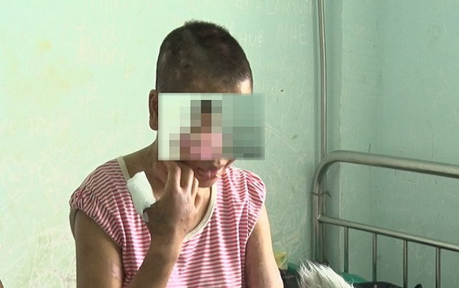 Vụ đi làm thuê bị chủ nhà tra cắt tai, ủi bàn là lên mặt - Thiếu nữ muốn bỏ trốn thì bị dọa: 'Chỉ cần về tới nhà là thấy xác mẹ nằm đó' Ảnh 2