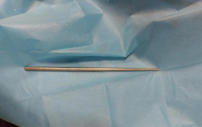 Dùng đũa inox dài gần 30 cm móc họng, cô gái gặp kết cục nhớ đời Ảnh 2