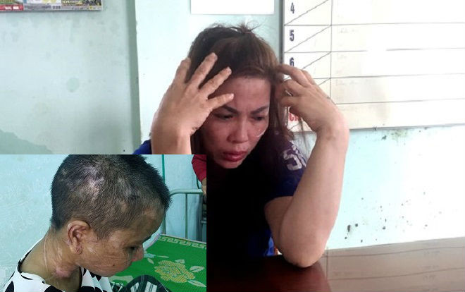 Truy tìm thêm người 'chị em kết nghĩa' cùng nữ chủ nhà đánh đập, tra tấn dã man người giúp việc Ảnh 2