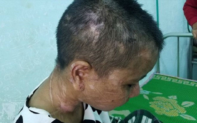 Vụ đi làm thuê bị chủ nhà cắt tai, bẻ răng, đạp sẩy thai: Xót lòng gia cảnh cùng cực và mong muốn của gia đình nạn nhân Ảnh 2