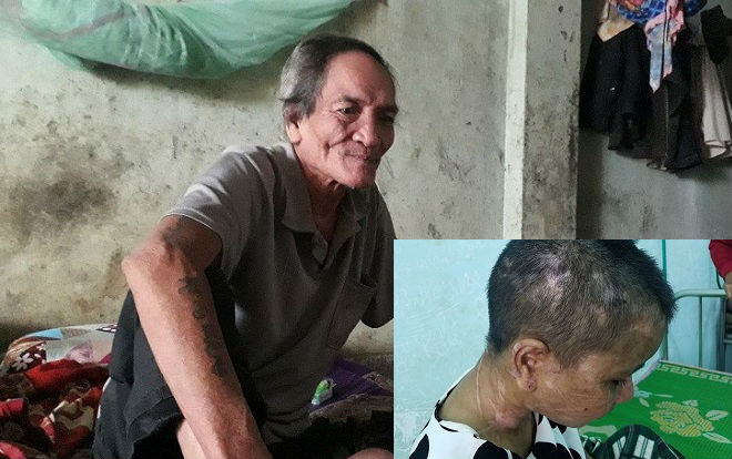 Vụ giúp việc bị chủ nhà tra tấn dã man như thời trung cổ: Nghẹn lòng nghe kể lại giây phút đón nạn nhân về cưu mang Ảnh 2