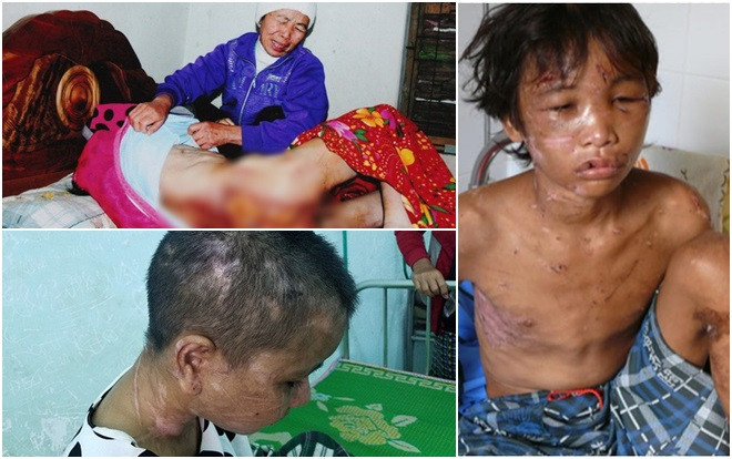 Trước vụ cô gái bị tra tấn dã man như thời trung cổ: Từng có những vụ hành hạ người làm thuê nào khiến dư luận dậy sóng? Ảnh 2