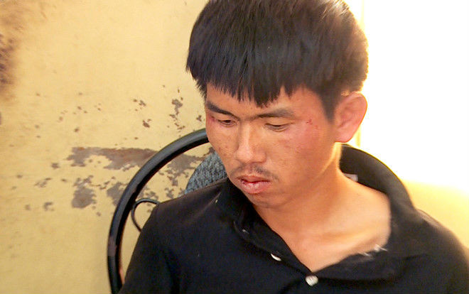 Nam thanh niên dùng dao chặt dừa chém xối xả chủ quán rồi cướp vòng vàng và xe máy Ảnh 2