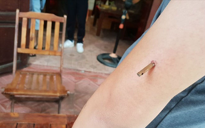 Chủ quán cà phê bị đối tượng côn đồ dùng súng bắn trước cửa nhà Ảnh 2