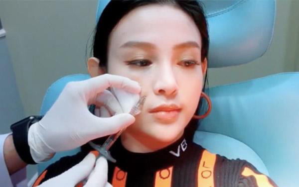 Huyền Baby gây sốc khi đăng tải clip tiêm filler để giữ khuôn mặt không tuổi Ảnh 2