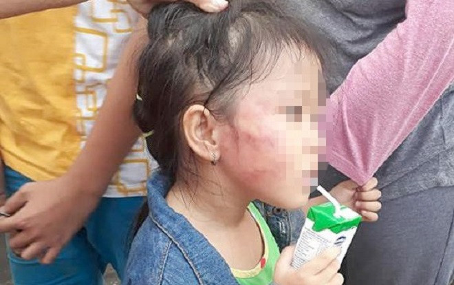 Lời khai bất ngờ của bảo mẫu đánh trẻ sưng mặt ở Sài Gòn Ảnh 2