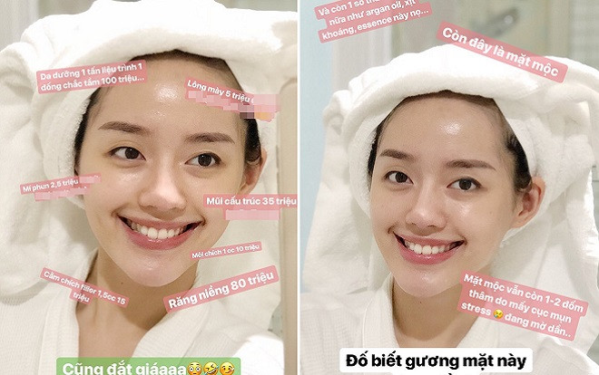Theo trend, Khánh Linh The Face tự 'bóc giá' gương mặt đã được thẩm mỹ lên đến hàng trăm triệu đồng! Ảnh 2