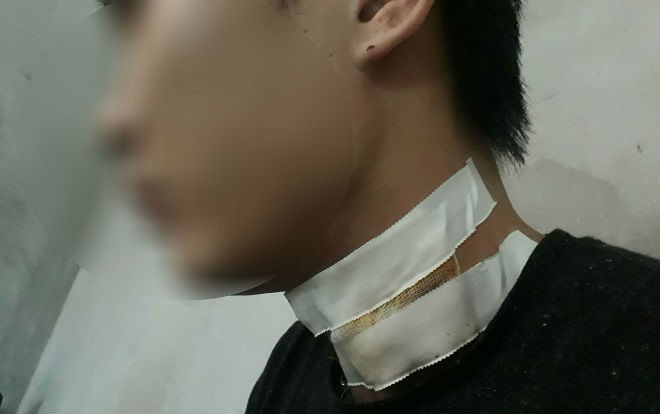 Tài xế taxi bị khách cầm dao khống chế cứa cổ trong đêm Ảnh 2