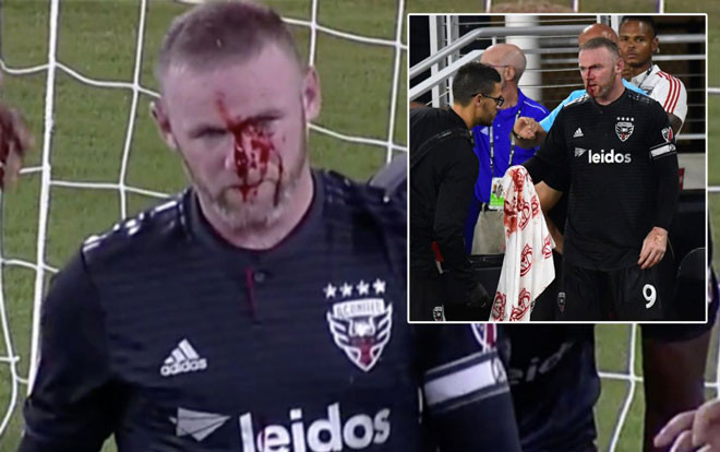 Cận cảnh pha chấn thương ghê rợn của Rooney Ảnh 2