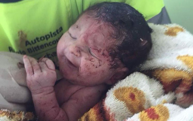 Văng khỏi bụng mẹ sau tai nạn giao thông thảm khốc, thai nhi sống sót kỳ diệu Ảnh 2