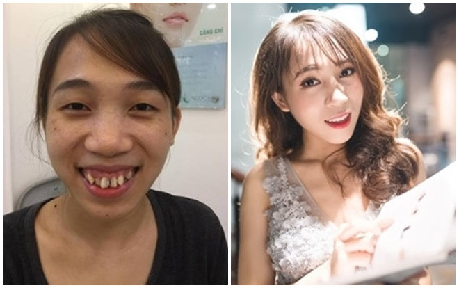 Nhờ phẫu thuật thẩm mỹ, 5 cô gái biến thành hot girl khiến dân mạng xôn xao Ảnh 2